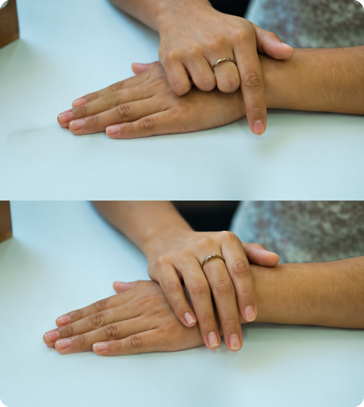 Hand Reconstruction success story